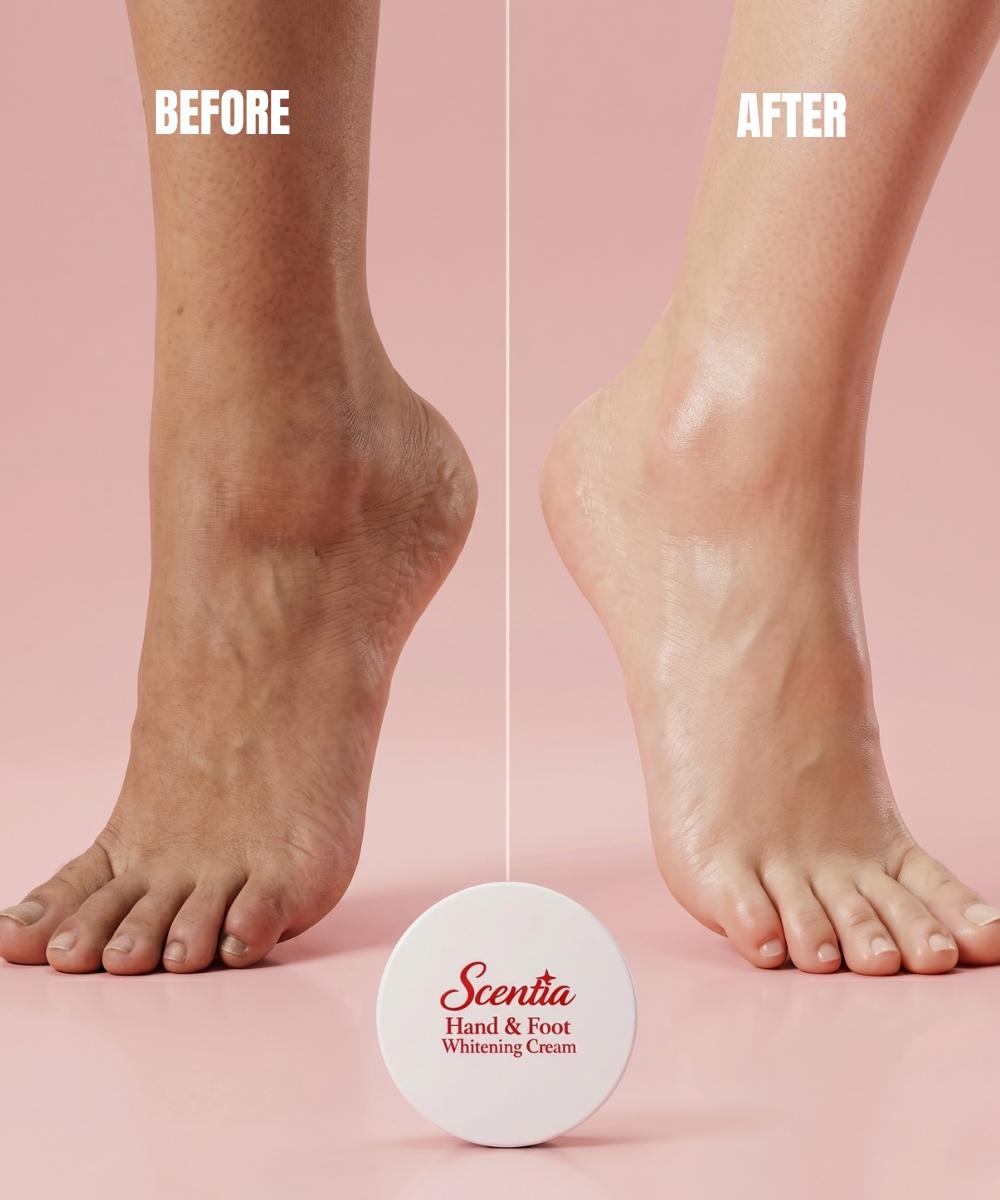 Scentia Hand & Foot Whitening Cream 100g – Deep Moisturizing Instant Brightening Cream❤️